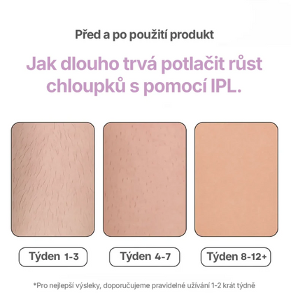 EPILORA: IPL Laserový Odstraňovač Chloupků
